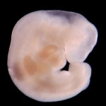 третья неделя беременности