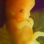 седьмая неделя беременности