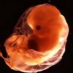 восьмая неделя беременности