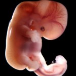 девятая неделя беременности