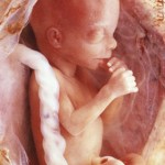 13 неделя беременности