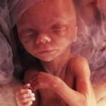 14 неделя беременности