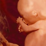 17 неделя беременности