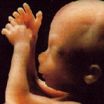 18 неделя беременности